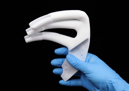 Gloved hand holding Anatomics StarPore Thoracic Implant