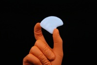 Acrylic Cranial Implant image 1