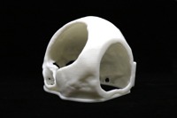 Acrylic Cranial Implant image 1