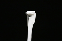 Titanium Implant Image 3